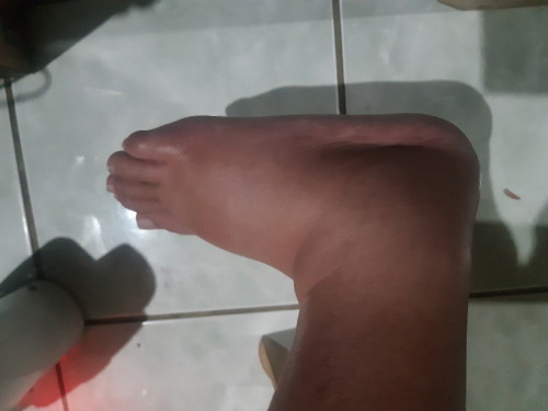 Manas sa buntis