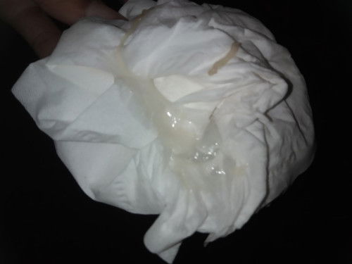 ท้อง12สัปดาห์ มีแบบนี้ออกมาปกติมั๊ยคะ