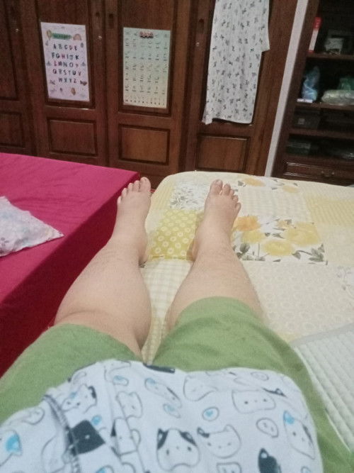 Kaki bengkak pasca sc