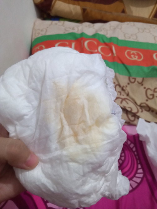 Warna pipis bayi