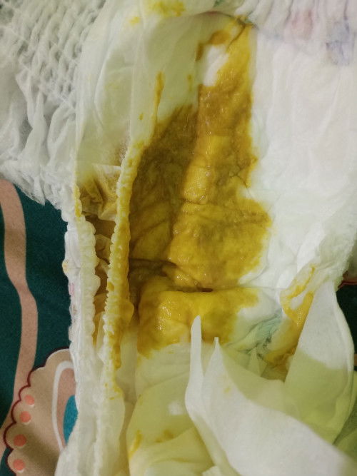 Mom, normal gak sih baby 3bulan susu soya pup nya gini? Kemaren tidak gini padahal. Makasih mom