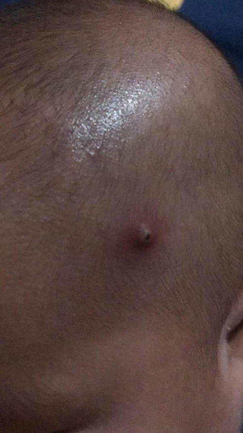 Obat untuk bayik yang aman