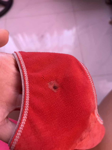 Discharge parang dugo sya nagulat ako pagkagising ko