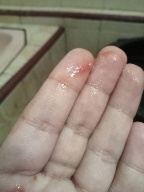 Lendir coklat kemerahan