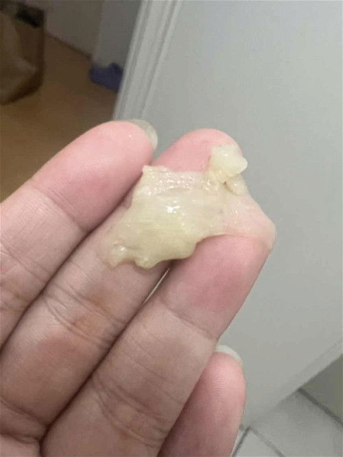 MUCUS PLUG PO BA ITO?