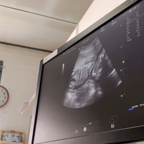 สอบถามแม่ๆหน่อยค่ะ