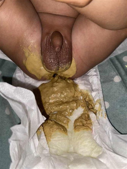 Pup bayi 3 bulan apakah normAll?