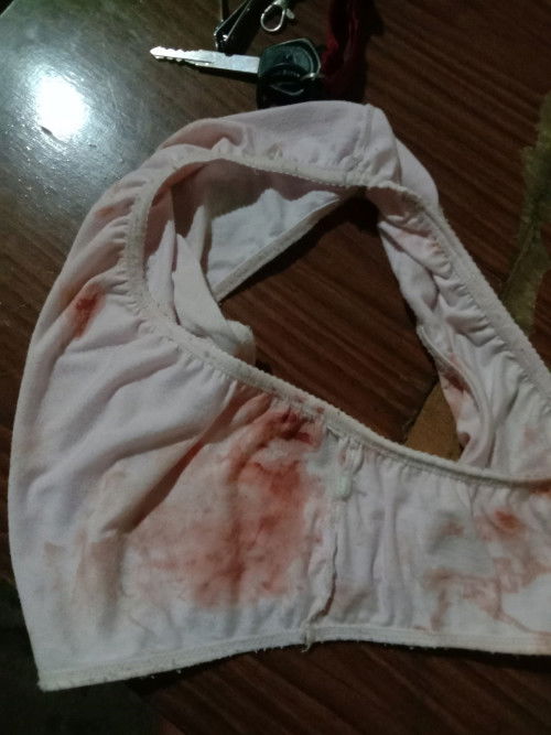 Bunda² serius mau tanya, kalau keluar darah begini, tanda mau lahiran kah? Kontraksi belum intens,