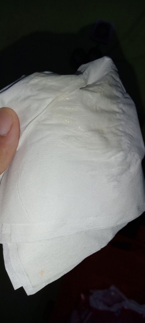 Gelisah hpl 17 blm ada kontraksi