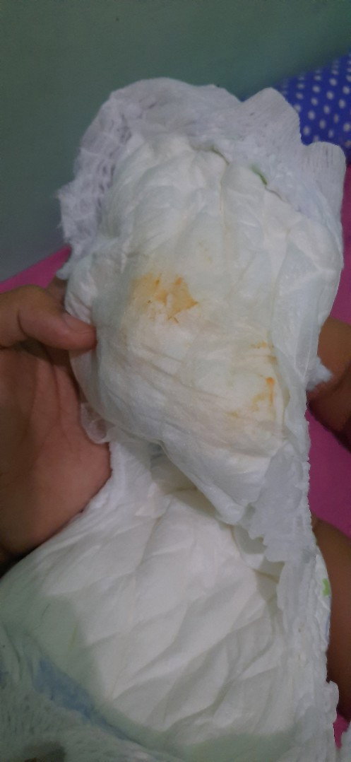 bun popok bayi ada bercak kuning agak pink gini bahaya ga bun?