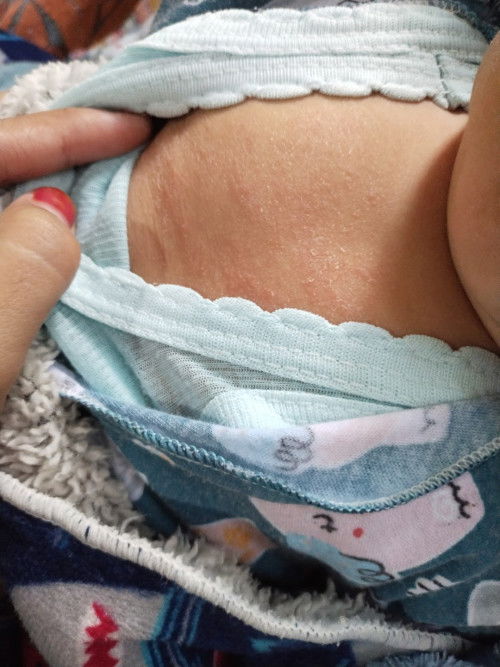 Ini penyebabnya apa ya bund?