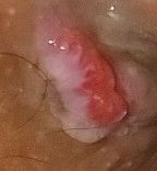 คลอดธรรมชาติ