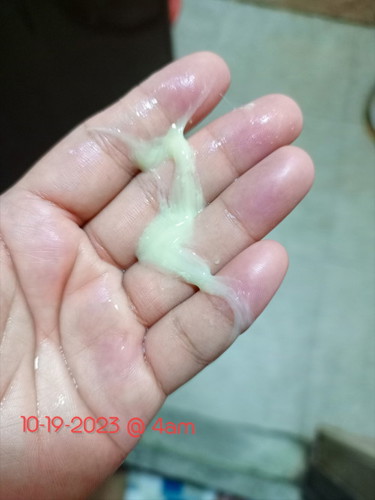 Good day po. Ftm here at 39weeks 3/7 na po now, panay sakit lang puson,balakang,p*p* at may dscharge