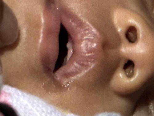 Is this how teething looks like?