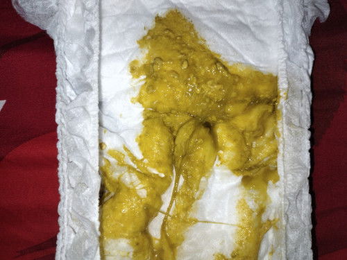 Pup bayi berwarna kuning berlendir