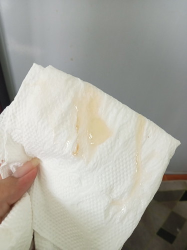 อาการใกล้คลอด