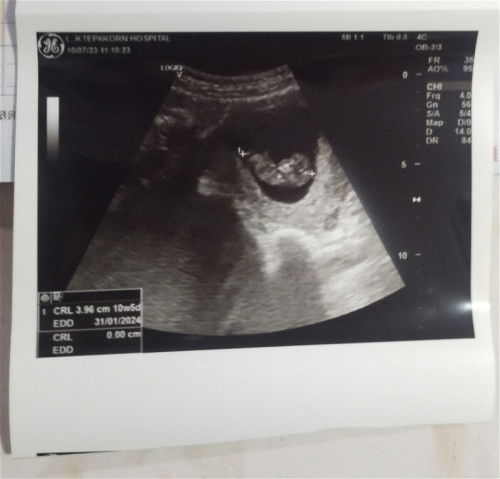 อยากถามแม่ๆพอมองรู้ไหมหญิงหรือชายแม่บ้านนี้ลุ้นมากๆ