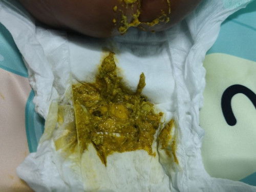 อุจจาระน้องแปลกๆ