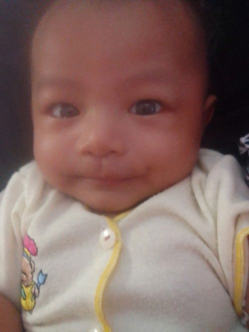 sakit mata bayi 3 bulan