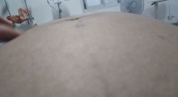 กลัวคลอดก่อนกำหนดค่ะ