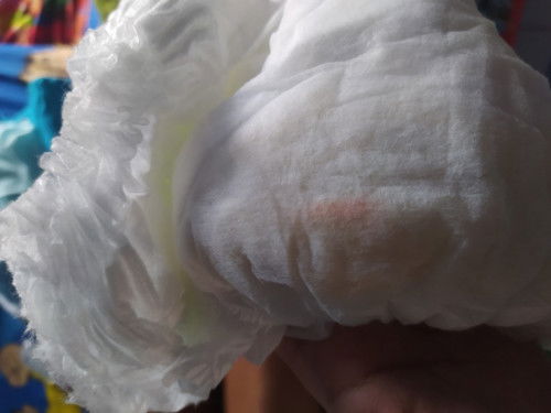 Anak pertama Bun jadi worry