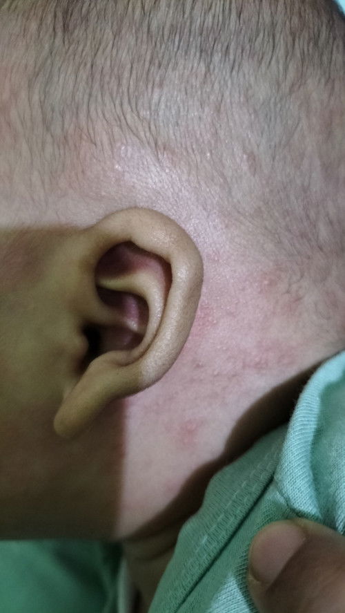 Alergi obat atau bukan??