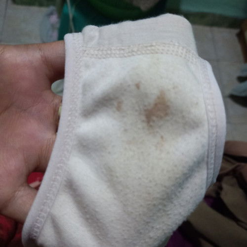 Keluar flek lagi setelah 10 hari tidak flek..kenapa ya bun?