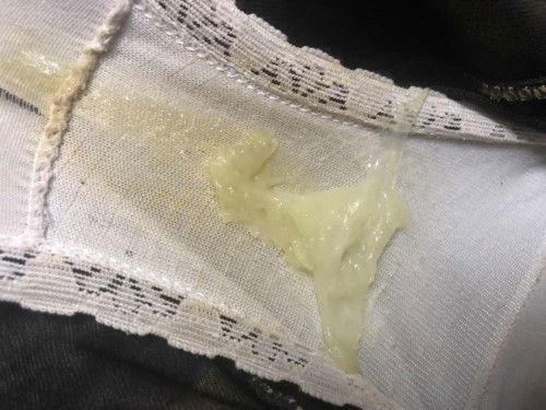 สอบถามแม่ๆหน่อยค่ะ
มีมูกแบบนี้ควรไป รพ. มั้ยคะ