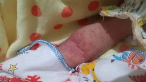 Sensitif/suhu ruang tolong di jawab bun