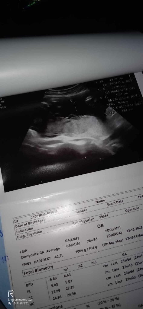 ช่วยดูเพศลูกหน่อยค่ะ