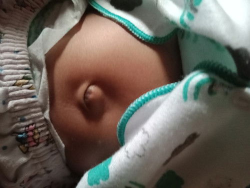 Mau tanya dong Bun ini perut bayi ku normal nggak ya umur nya 1 bulan ...mohon jawabannya bunda🙏