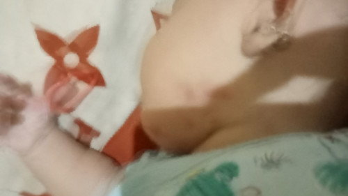 Obat luar untuk kulit bayi sensitif
