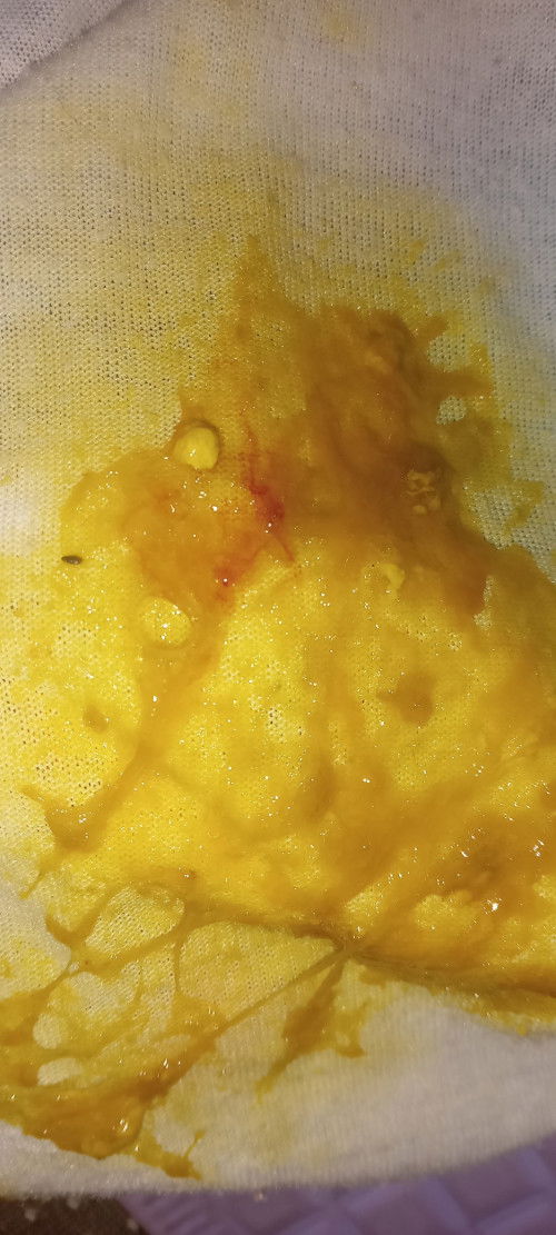 Bab bayi ada Darah nya