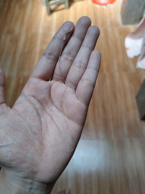 มีเส้นไหมออกมาจากช่องคลอด