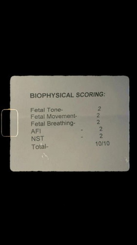 PERFECT SCORE