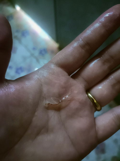 มูกเหลือดใสอันตรายไหม