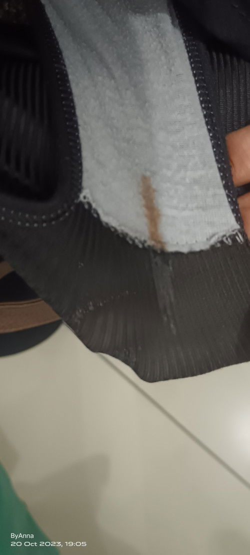 Bleeding or spotting?