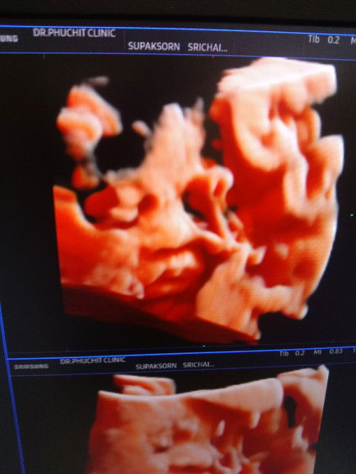 30 วีค หนัก 1,200