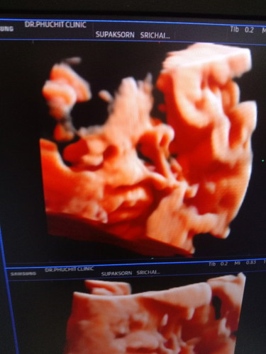 30 วีค หนัก 1,200