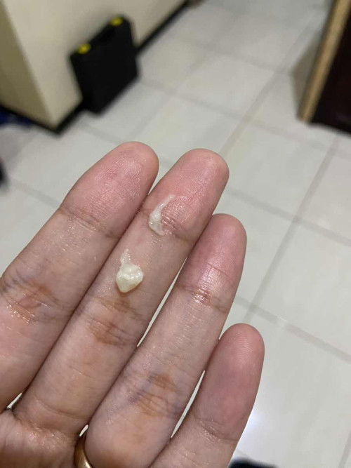 Keputihan di trimester 1