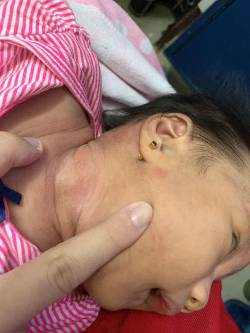 Ano po kaya ung nasa face ni baby?