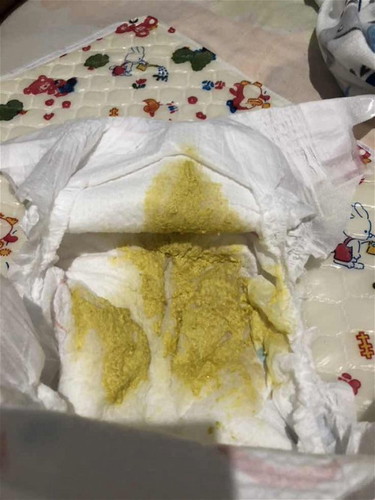 ลูกถ่ายแบบนี้ปกติไหมคะ