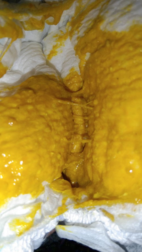 Pup bayi 2 bulan seperti ini, dr nb smpe skrg klo pup bisa 5x sehari normal ga ya Bun?