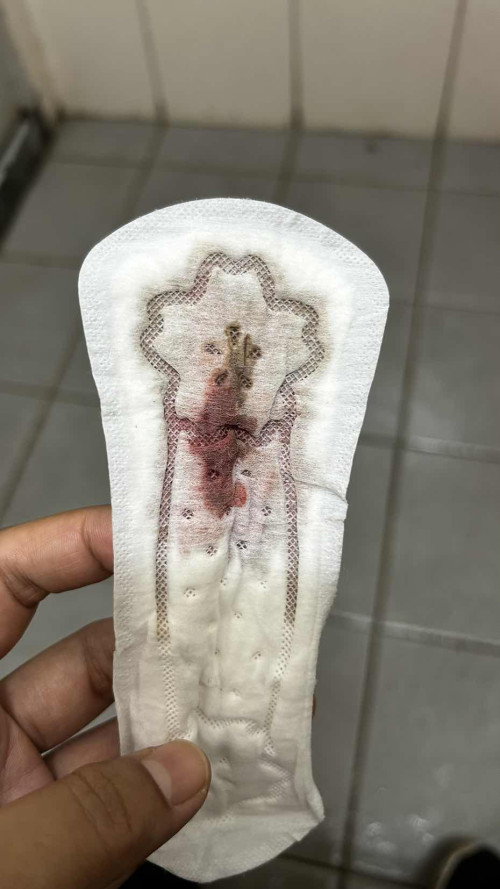 Keluar darah pada w6d6 dengan jumlah agak banyak. Bahaya atau tidak?