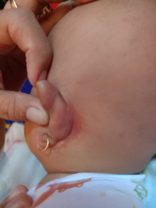 Luka dibelakang telinga