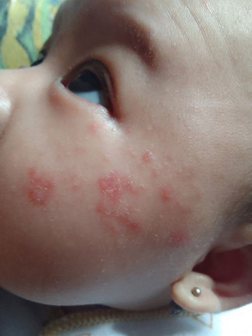 Kulit anak saya sensitif