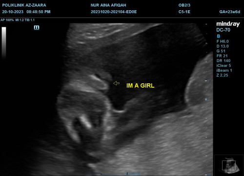 Scan tak accurate