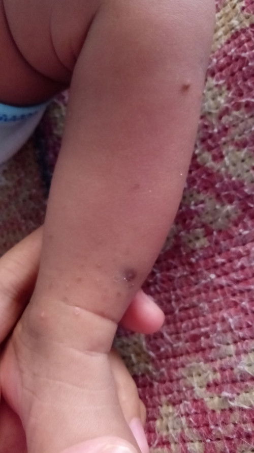 Solusinya dong bunda²