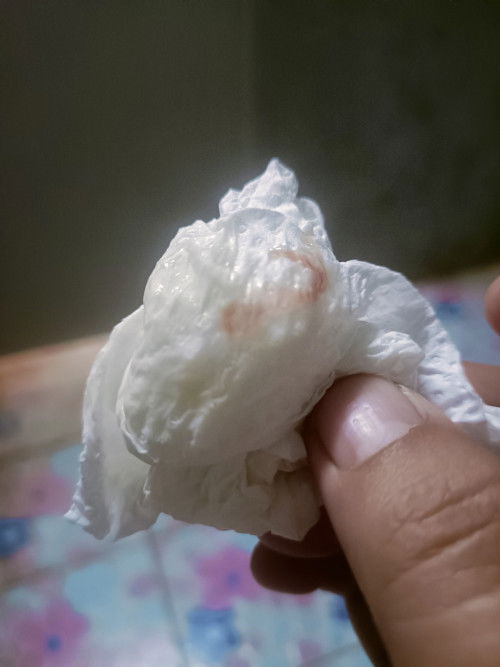 ปากมดลูกบาง