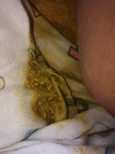 สอบถามเเม่ๆค่ะ